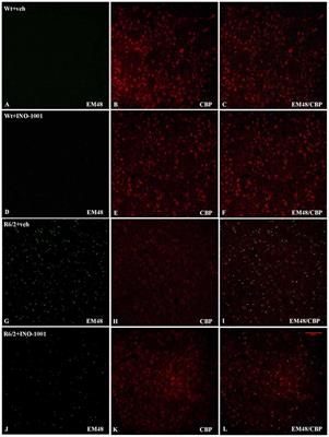 Selective Sparing of Striatal Interneurons after Poly (ADP-Ribose) Polymerase 1 Inhibition in the R6/2 Mouse Model of Huntington’s Disease